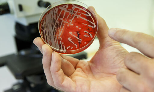 WHO slår alarm: Multiresistente bakterier sprer seg på sykehus i Europa