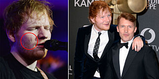 Ed Sheeran vekket oppsikt med kongelig sverdulykke. Nå avslører kompisen sannheten