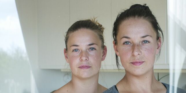 Ann og Jill er eneggede tvillinger, men har taklet livet forskjellig